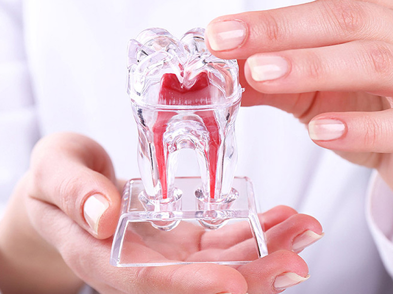 endodoncija, lijecenje zubnog kanala